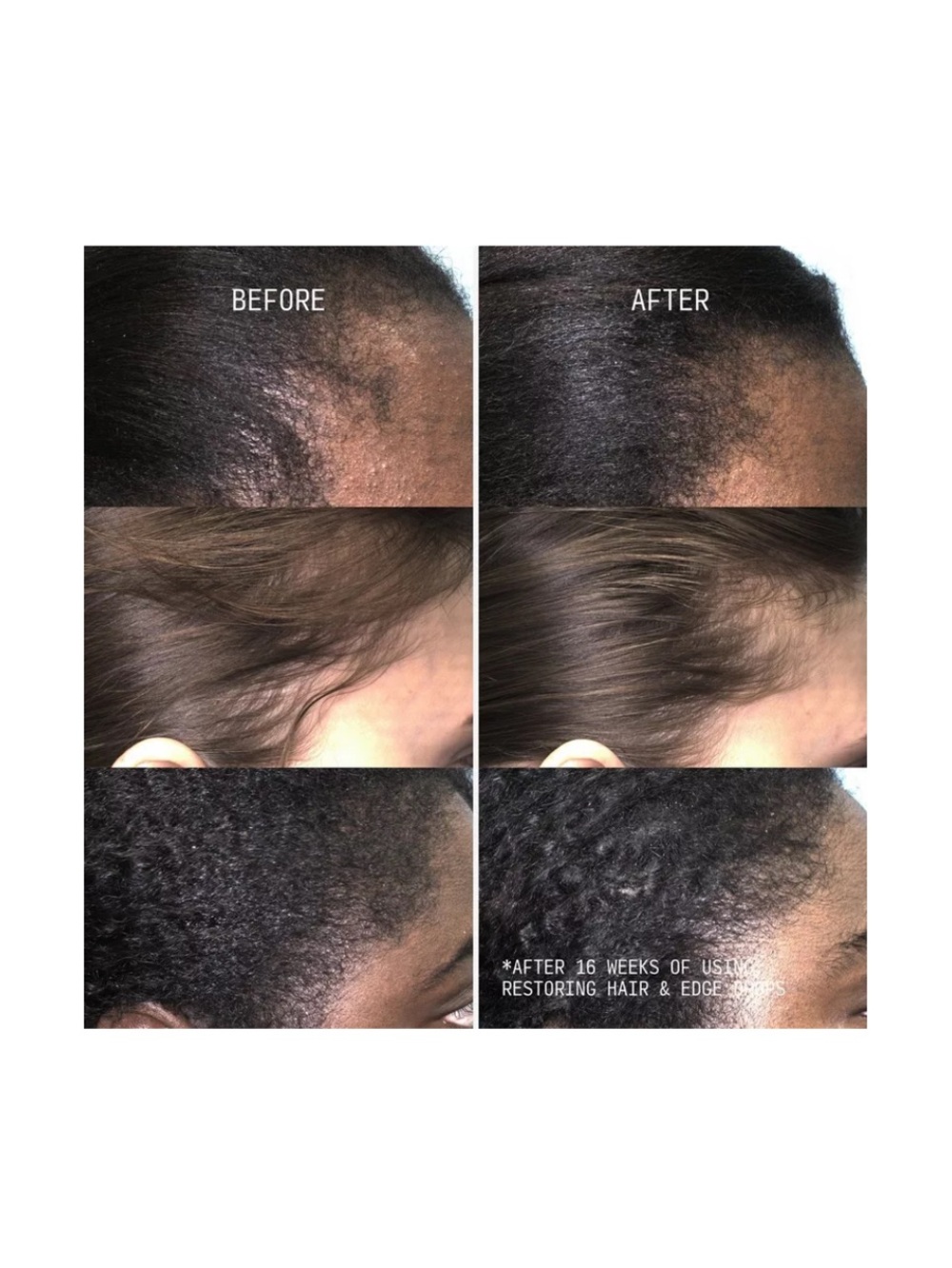 Cécred Silver Restoring Hair & Edge Drops - Picture 5 of 6